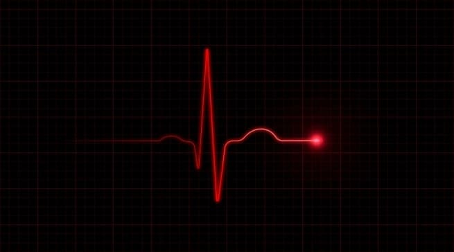 red heartbeat monitor line on a black background